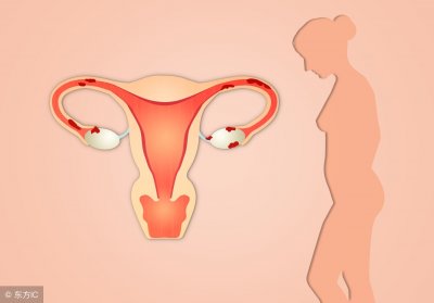 ​女人吃什么保养卵巢（3种食物女性该多吃）