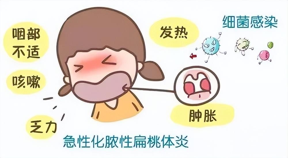 扁桃体发炎最怕一碗水(扁桃体发炎怎么办？)