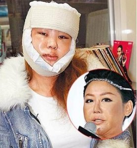 ​蓝心湄整容了吗（蓝心湄萧淑慎黄舒骏 公开整容术）