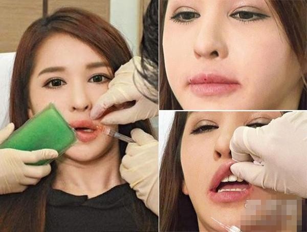 蓝心湄整容了吗（蓝心湄萧淑慎黄舒骏 公开整容术）