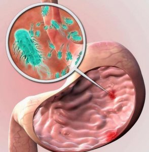 ​胃炎不能吃什么(胃炎不能吃什么水果)