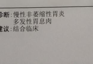 无痛胃镜多少钱一次2025(无痛胃肠镜亲身经历) 无痛胃镜多少钱一次2025(无痛胃肠镜亲身经历)