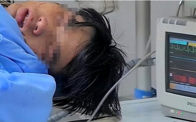 ​24岁男子百草枯中毒，死亡过程记录：临终前后悔，却为时已晚