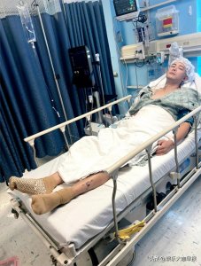 ​陈学冬发文自己已经做完第三次手术，＂头发已经白完啦＂!