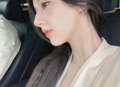 ​冯小刚得了什么病（冯小刚竟然患白癜风）